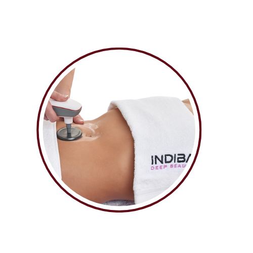 TRATAMIENTO INDIBA ATUAIRE3